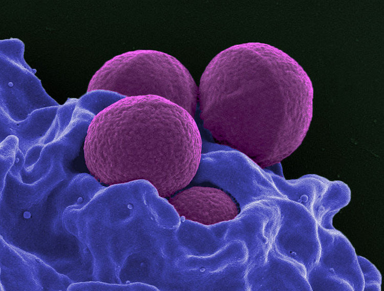 Types of Infection